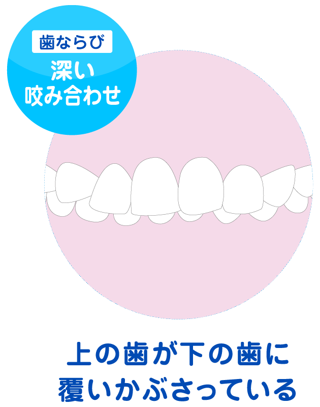 姫路市 Himeji Olivier Dental Clinic 小児矯正