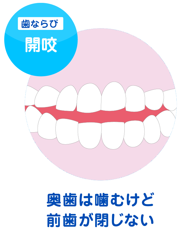 ひめじオリビエ歯科クリニック 初診を受ける男の子