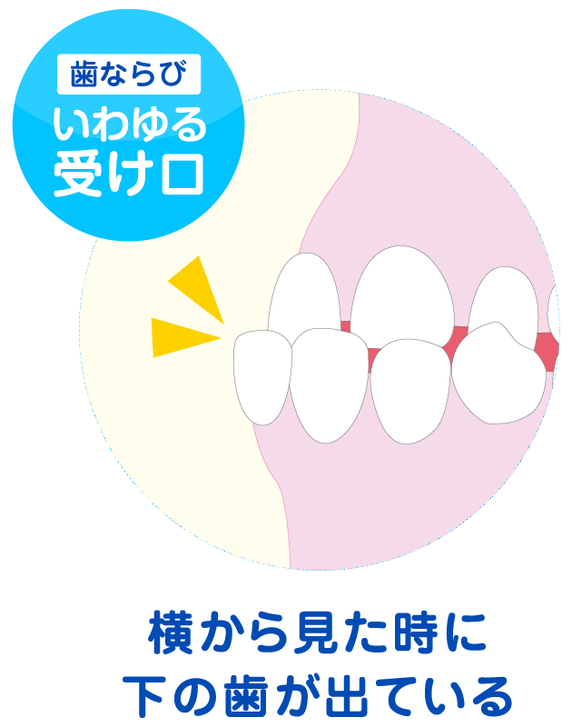姫路市 Himeji Olivier Dental Clinic 小児矯正